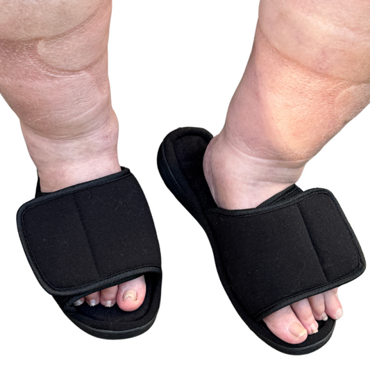 Slippers for Swollen Feet